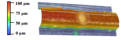 3D surface plot of a cylindrical object with a color scale indicating height from 0 to 100 µm, showing a raised central region.